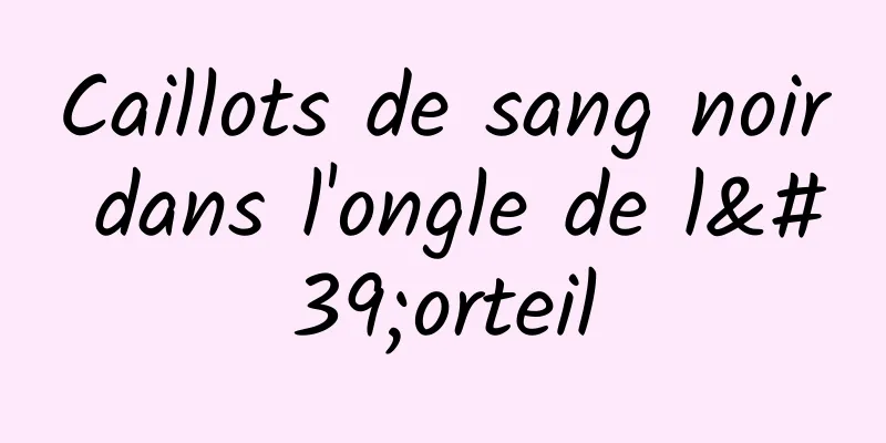 Caillots de sang noir dans l'ongle de l'orteil