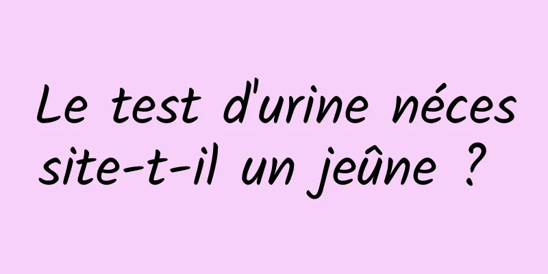 Le test d'urine nécessite-t-il un jeûne ? 