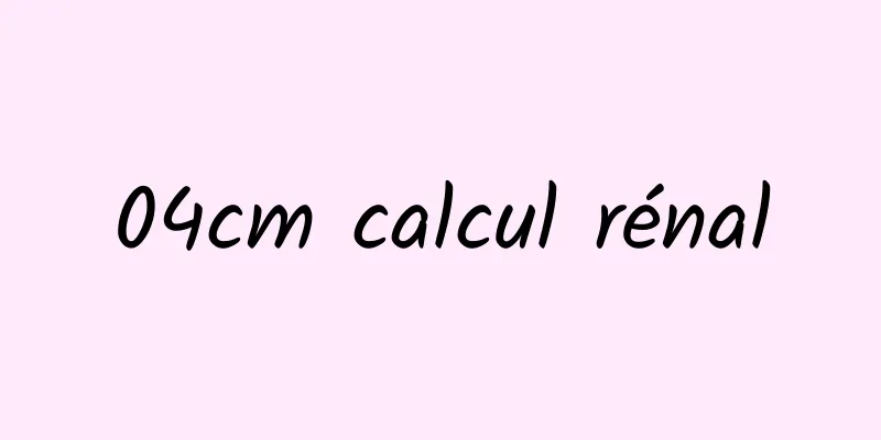 04cm calcul rénal