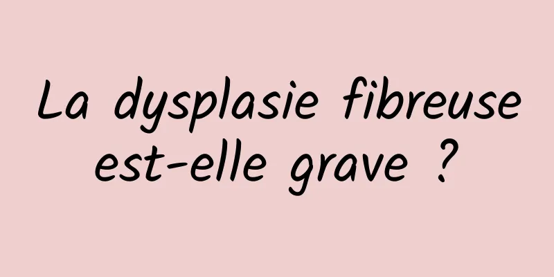 La dysplasie fibreuse est-elle grave ? 