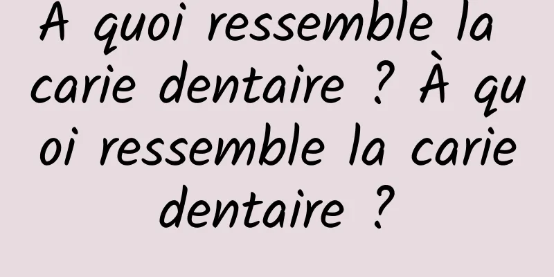 À quoi ressemble la carie dentaire ? À quoi ressemble la carie dentaire ? 