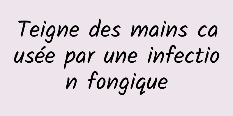 Teigne des mains causée par une infection fongique