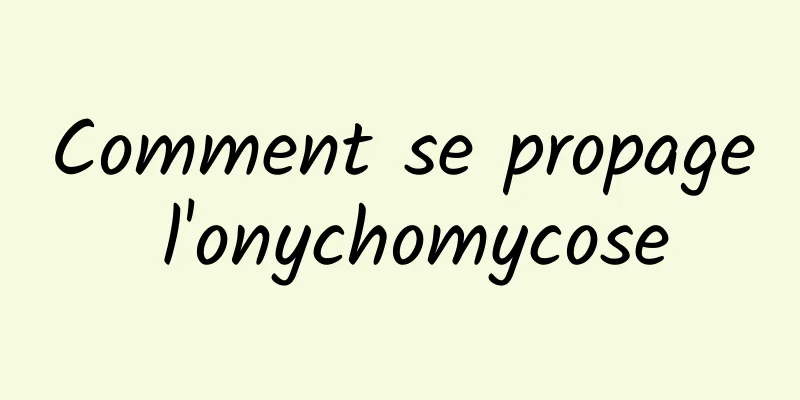 Comment se propage l'onychomycose