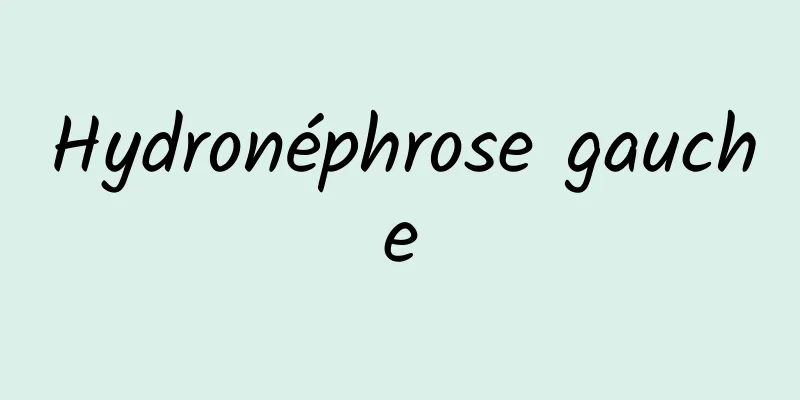 Hydronéphrose gauche