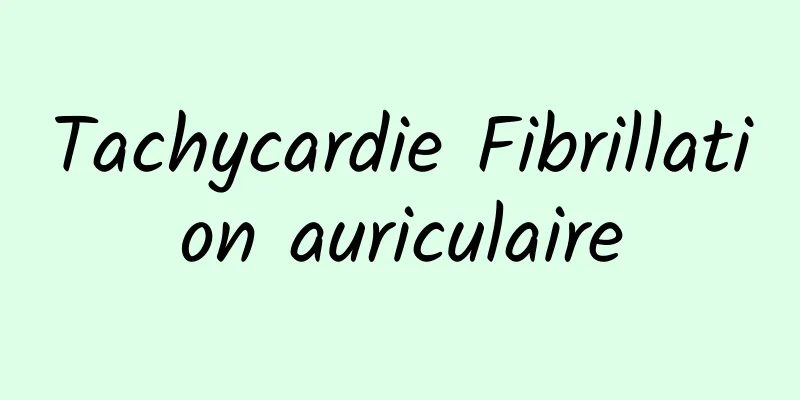 Tachycardie Fibrillation auriculaire