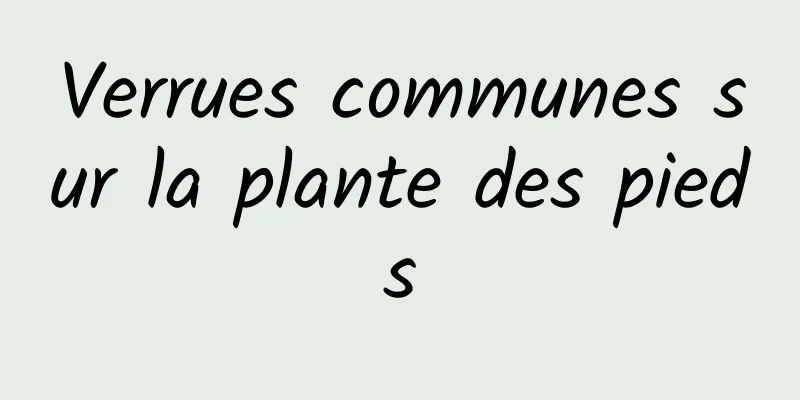 Verrues communes sur la plante des pieds