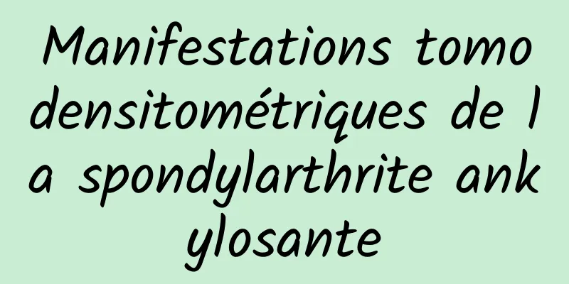 Manifestations tomodensitométriques de la spondylarthrite ankylosante