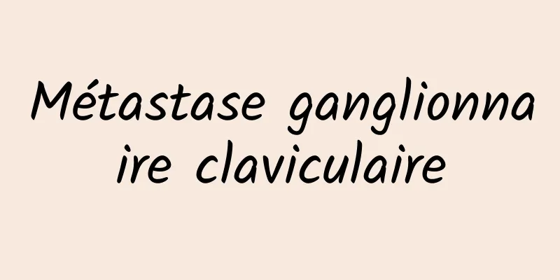 Métastase ganglionnaire claviculaire