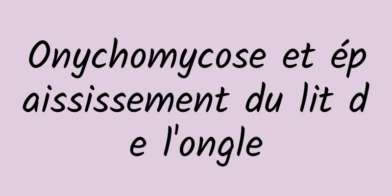 Onychomycose et épaississement du lit de l'ongle