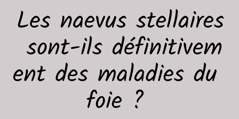 Les naevus stellaires sont-ils définitivement des maladies du foie ? 