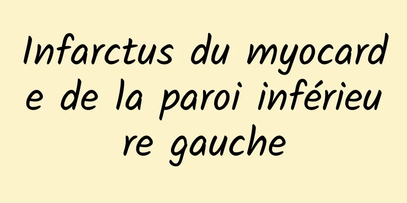 Infarctus du myocarde de la paroi inférieure gauche