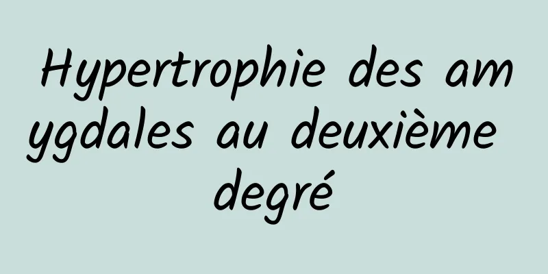 Hypertrophie des amygdales au deuxième degré