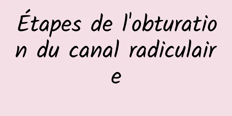 Étapes de l'obturation du canal radiculaire