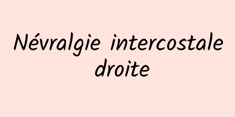 Névralgie intercostale droite