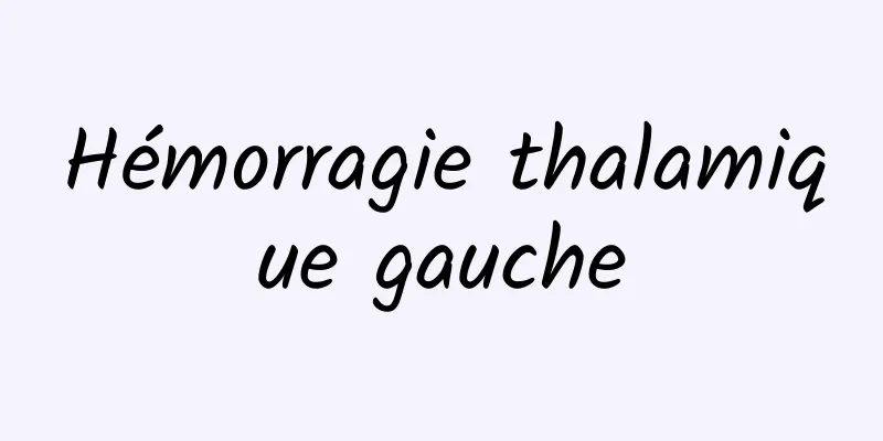 Hémorragie thalamique gauche