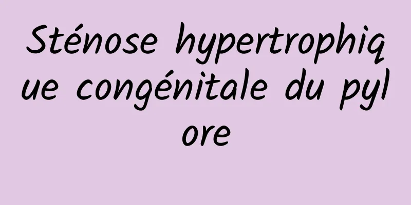 Sténose hypertrophique congénitale du pylore