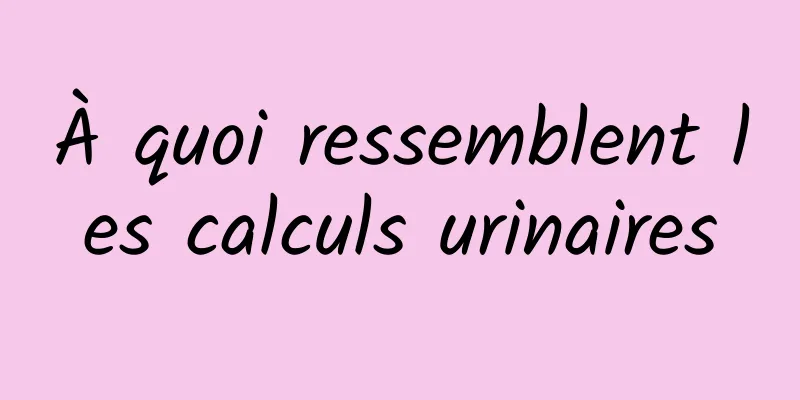 À quoi ressemblent les calculs urinaires