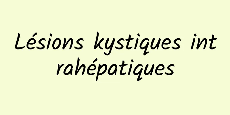 Lésions kystiques intrahépatiques