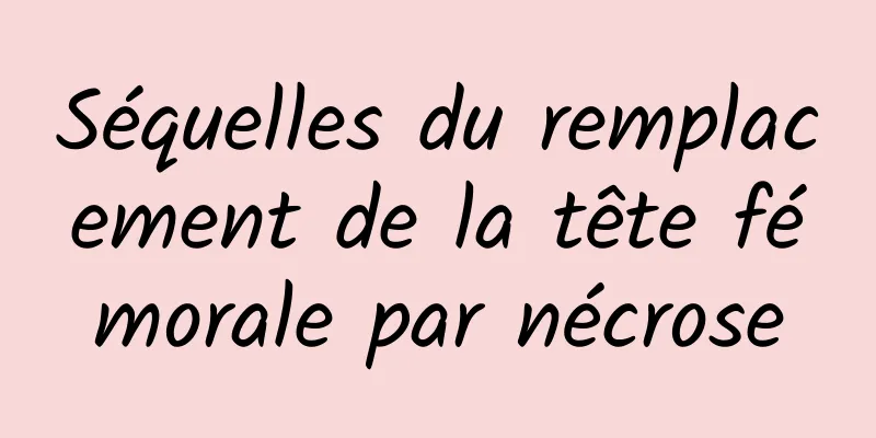 Séquelles du remplacement de la tête fémorale par nécrose