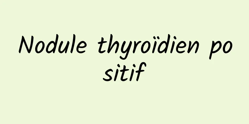 Nodule thyroïdien positif