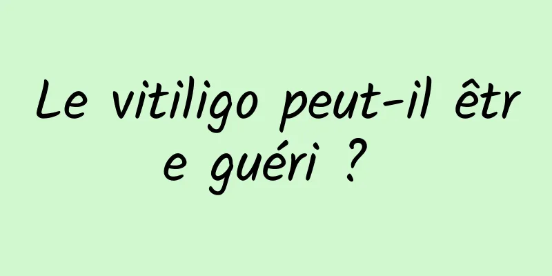 Le vitiligo peut-il être guéri ? 