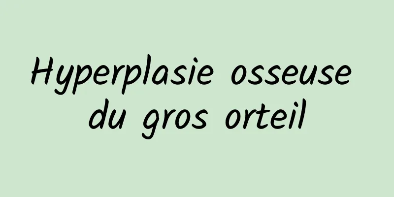 Hyperplasie osseuse du gros orteil