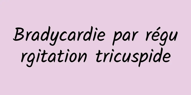 Bradycardie par régurgitation tricuspide