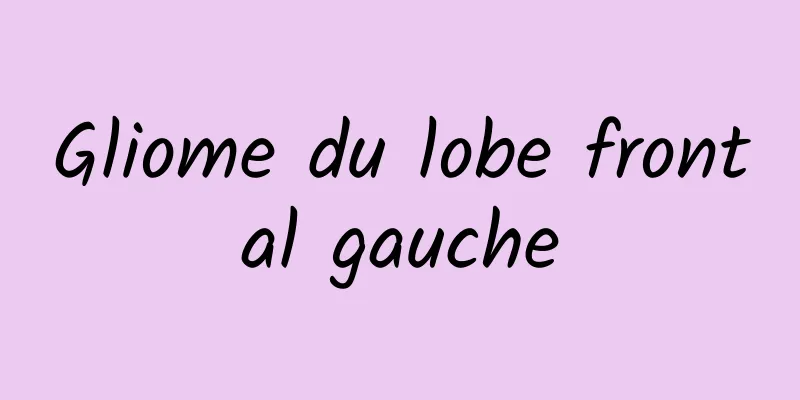 Gliome du lobe frontal gauche