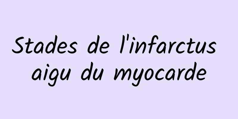 Stades de l'infarctus aigu du myocarde