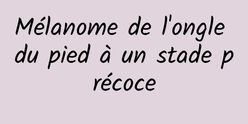 Mélanome de l'ongle du pied à un stade précoce