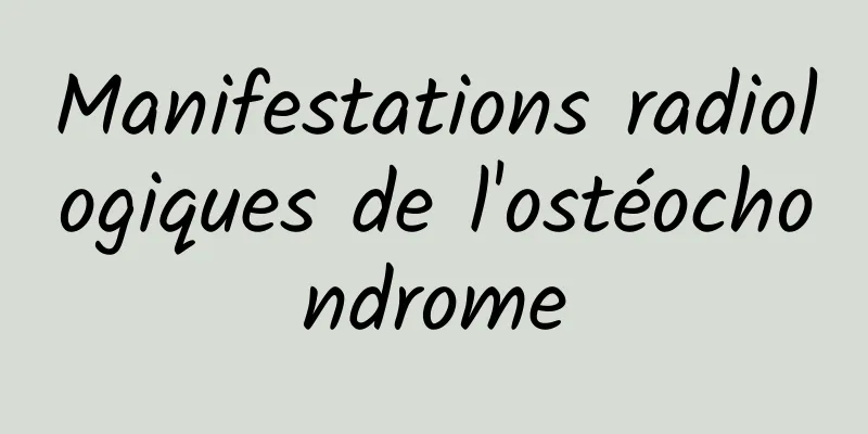 Manifestations radiologiques de l'ostéochondrome