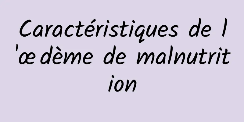 Caractéristiques de l'œdème de malnutrition