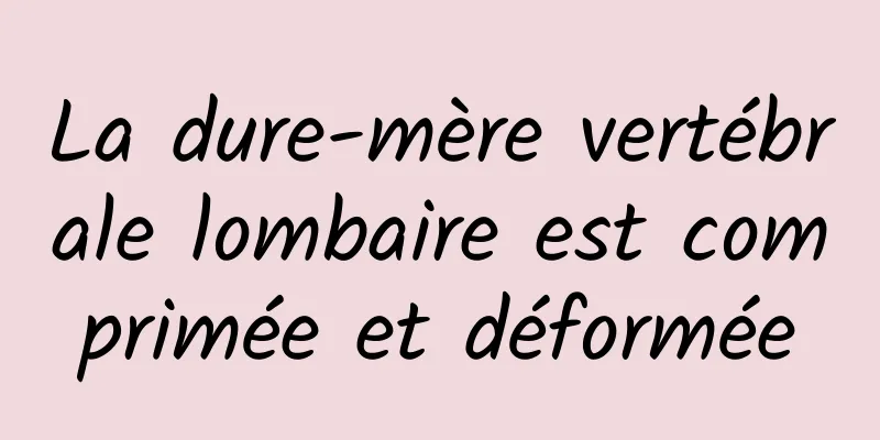 La dure-mère vertébrale lombaire est comprimée et déformée