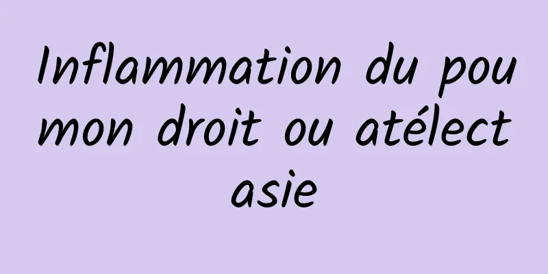 Inflammation du poumon droit ou atélectasie