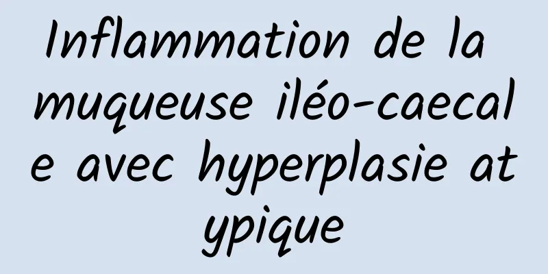 Inflammation de la muqueuse iléo-caecale avec hyperplasie atypique