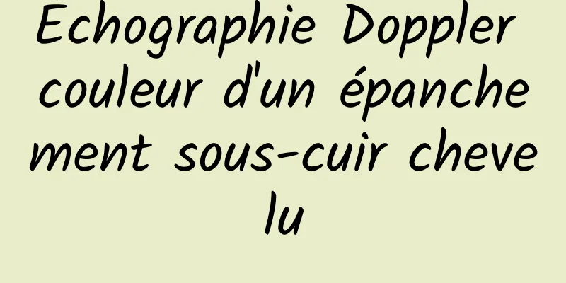 Échographie Doppler couleur d'un épanchement sous-cuir chevelu