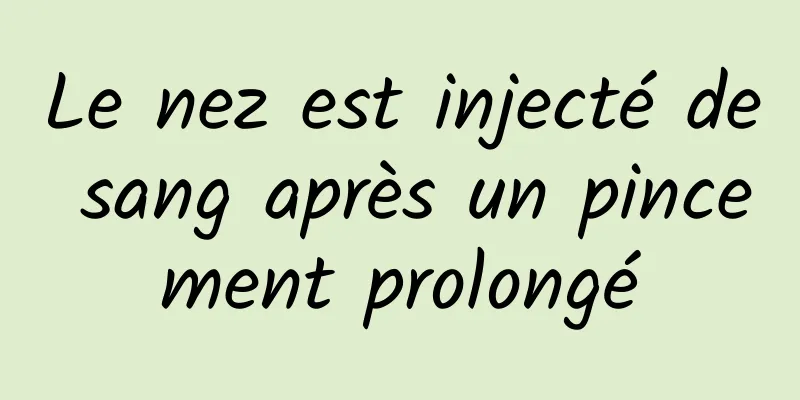 Le nez est injecté de sang après un pincement prolongé