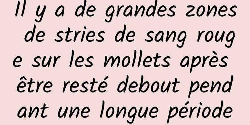 Il y a de grandes zones de stries de sang rouge sur les mollets après être resté debout pendant une longue période