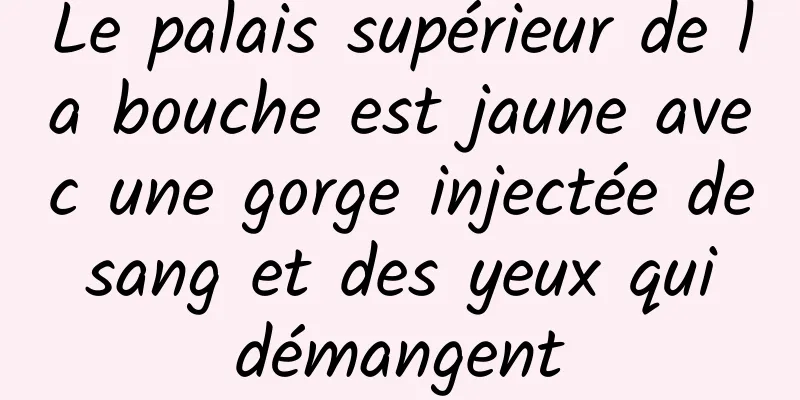 Le palais supérieur de la bouche est jaune avec une gorge injectée de sang et des yeux qui démangent