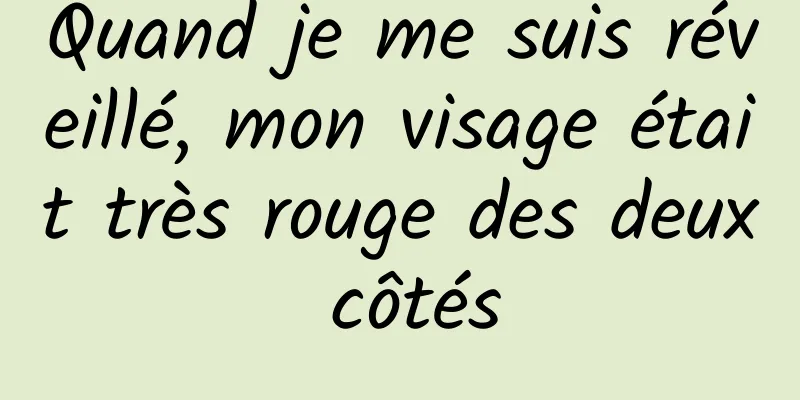 Quand je me suis réveillé, mon visage était très rouge des deux côtés