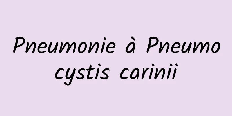 Pneumonie à Pneumocystis carinii