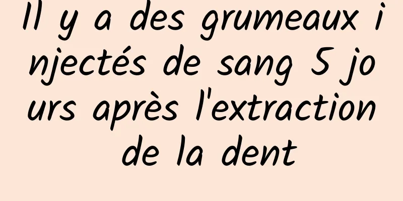 Il y a des grumeaux injectés de sang 5 jours après l'extraction de la dent