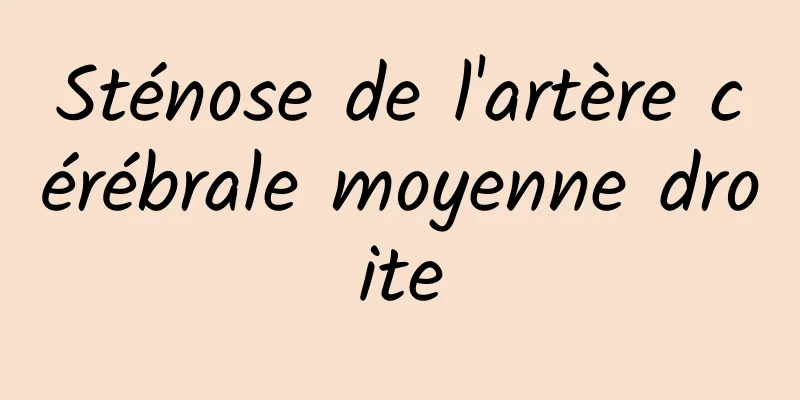 Sténose de l'artère cérébrale moyenne droite