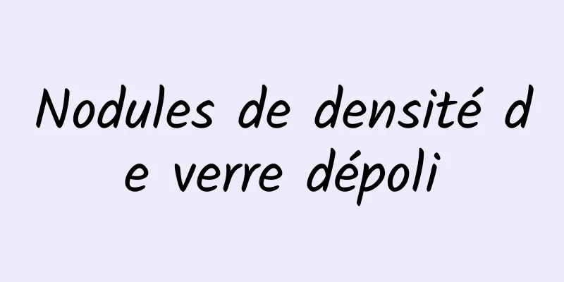 Nodules de densité de verre dépoli