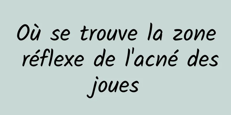 Où se trouve la zone réflexe de l'acné des joues 