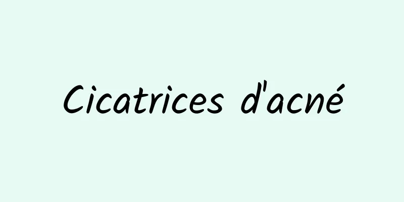 Cicatrices d'acné