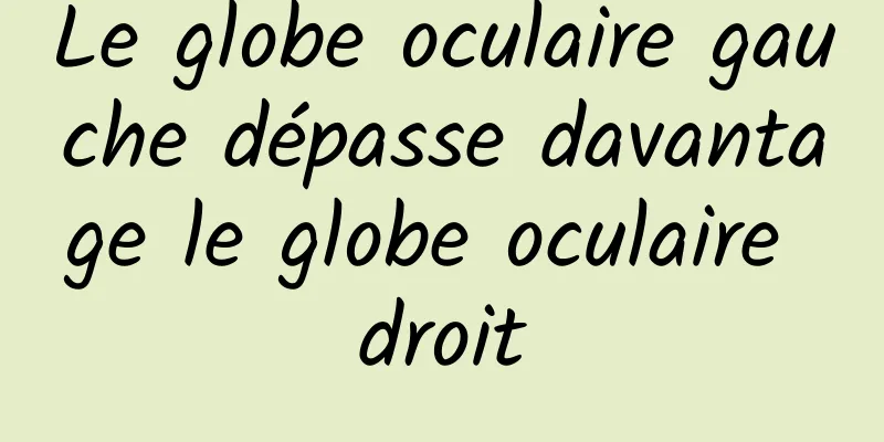 Le globe oculaire gauche dépasse davantage le globe oculaire droit