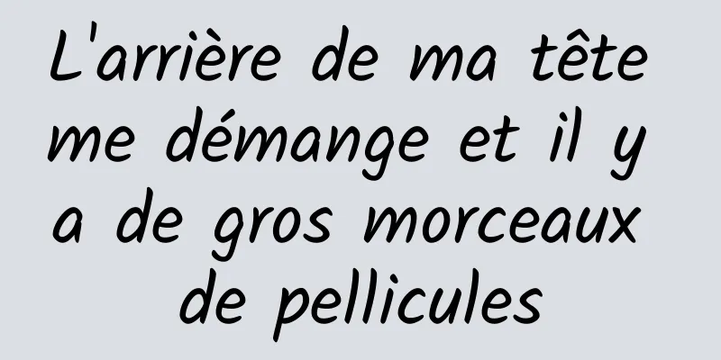 L'arrière de ma tête me démange et il y a de gros morceaux de pellicules