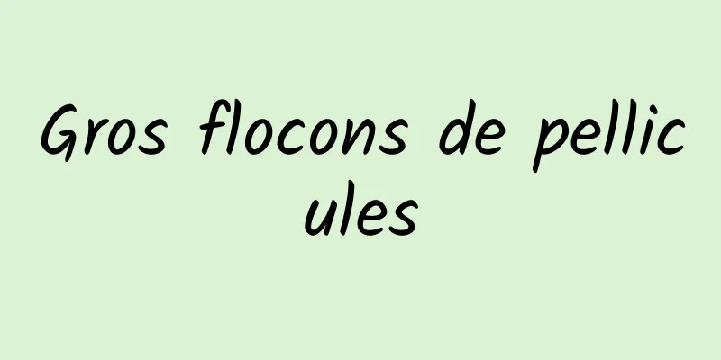 Gros flocons de pellicules