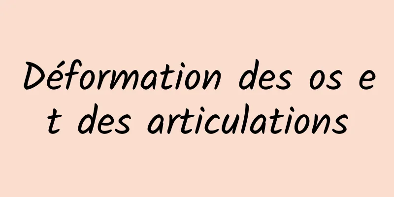 Déformation des os et des articulations